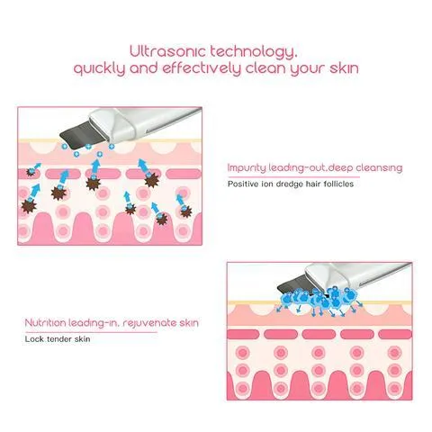 Ultimate Facial Spa Skin Scrubber: Vibration Massager for Deep Cleansing, Blackhead Removal, Pore Cleaning, and More