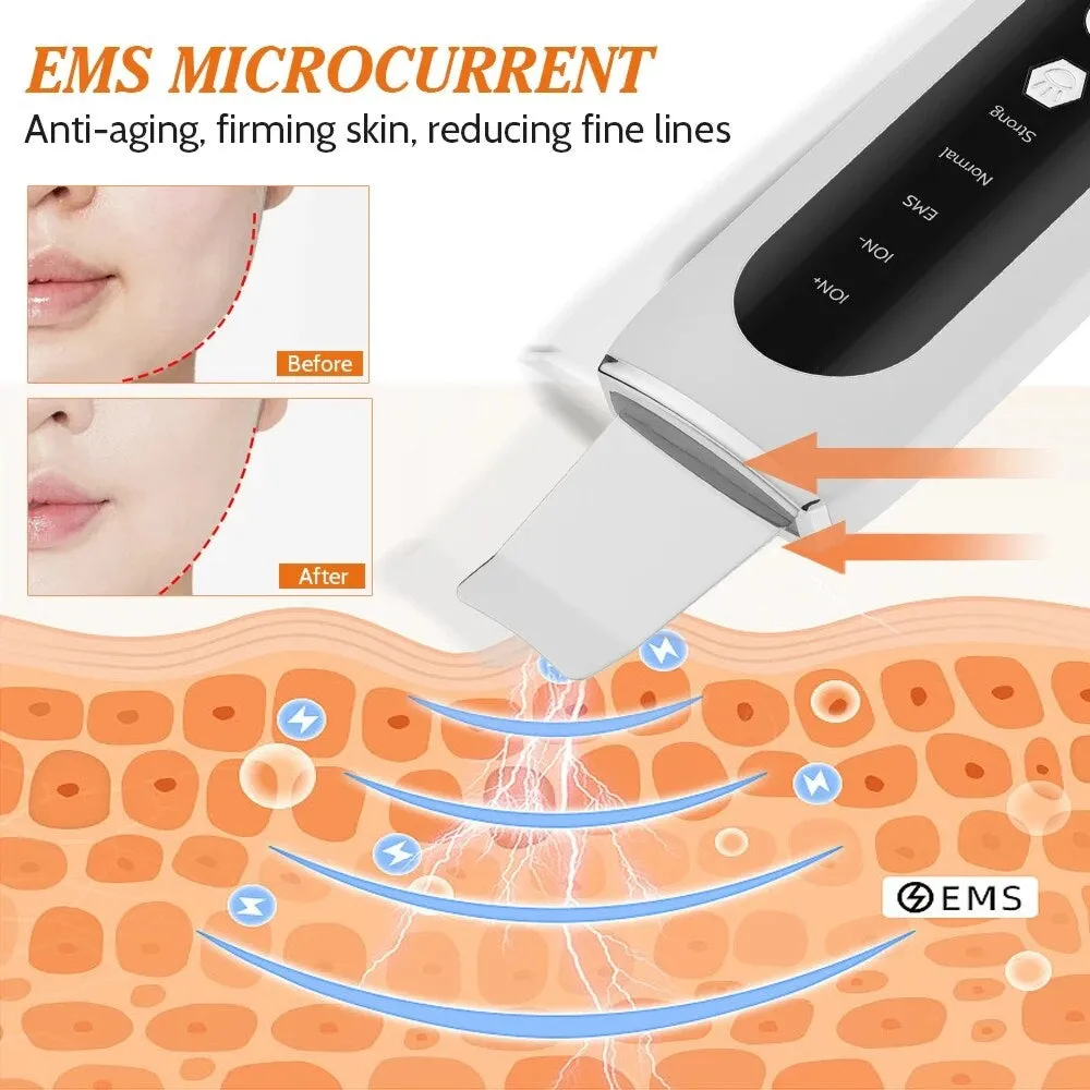 Ultrasonic shovel machine Facial Skin Scrubber Electric Blackhead Remover